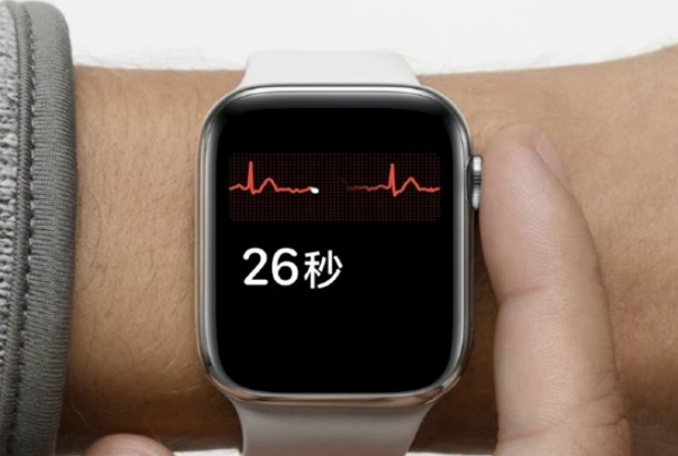 国行Apple Watch终于获得“完全体”！ECG心电图已上线